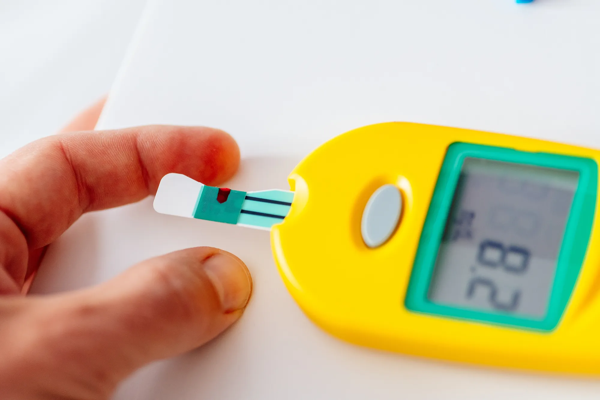 Blood uric acid level test.
