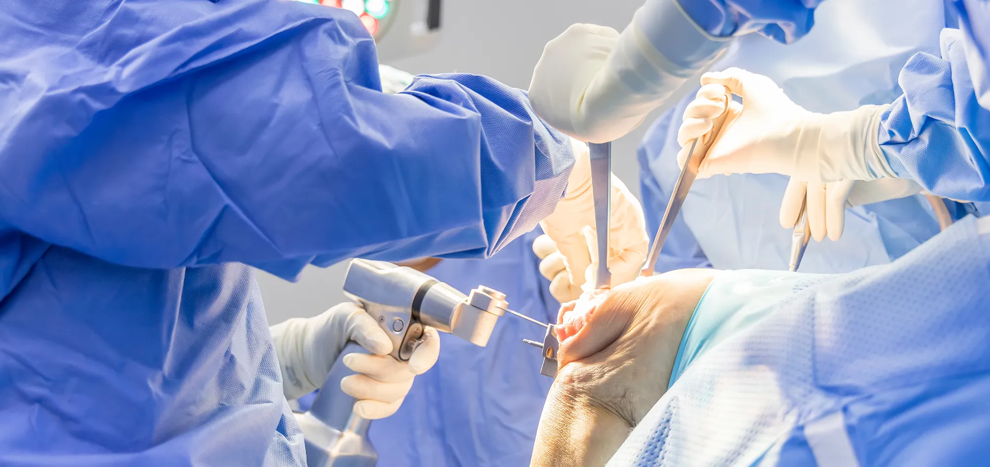 Selective focus with blurred background.Orthopedic surgeon in blue surgical gown suite using saw to cut the bone while total knee replacement surgery in osteoarthritis patient.Team of surgeons.