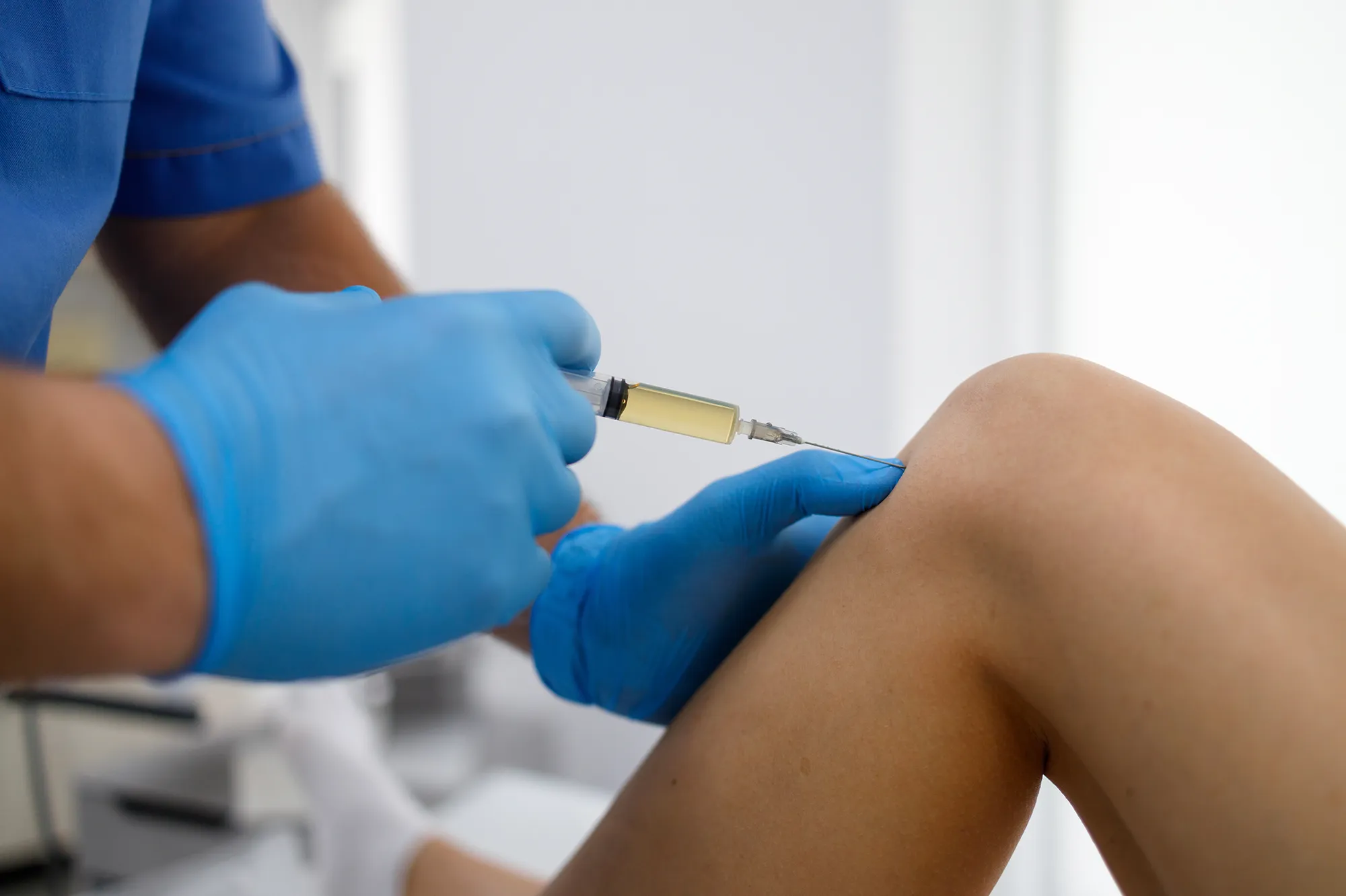 Treating knee pain with platelet-rich plasma injection. Treatment of arthritis and osteoarthritis
