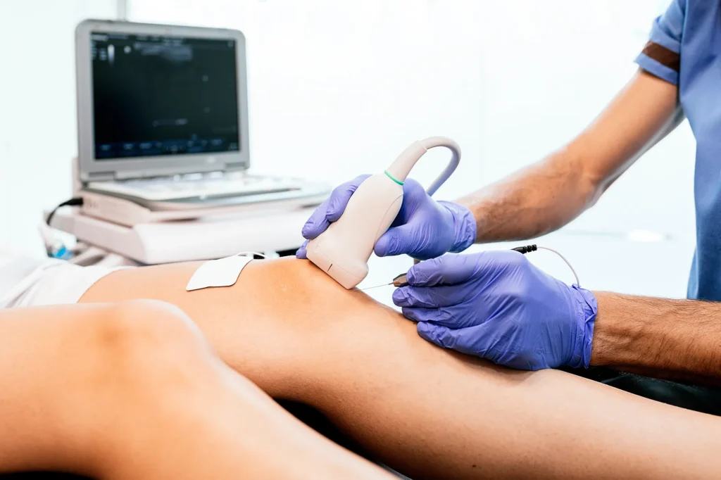 Physiotherapist giving knee therapy to a woman
